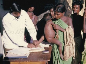 Vyplácení odměn za hlášení případů varioly v Indii (V. Zikmund)